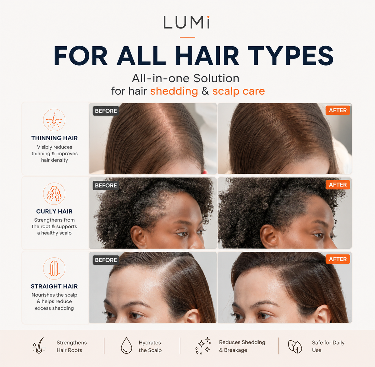 LUMi™ K-Hair EXOSOME Hair Renewal Serum | 100ml